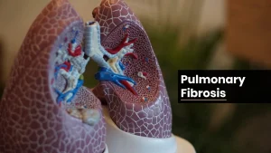 What is Pulmonary Fibrosis?